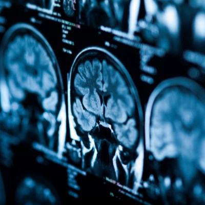 Brain X-ray closeup.