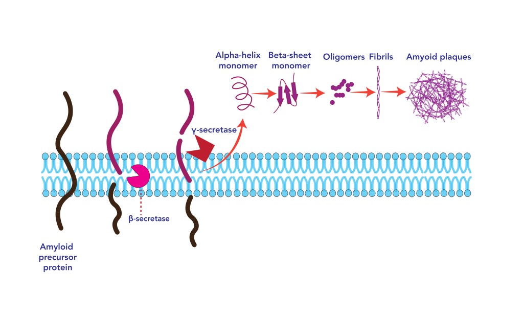 Diagram of amyloid plaque formation in Alzheimer's.